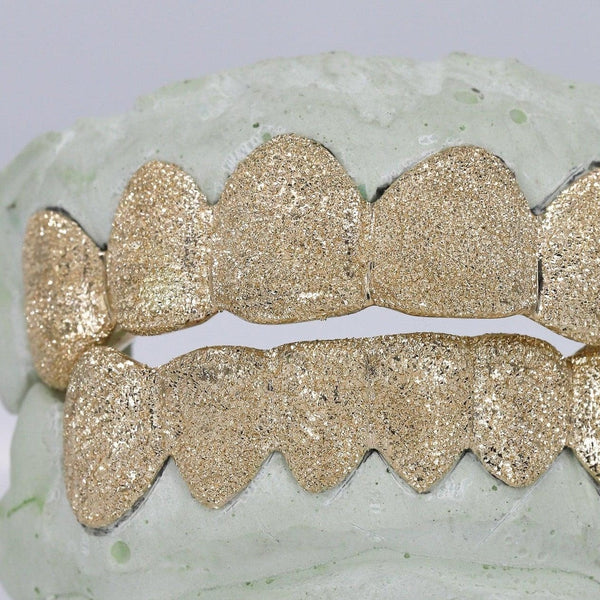 NPG Gold Diamond Dust Grillz
