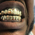 NPG 14 on 14 Grillz