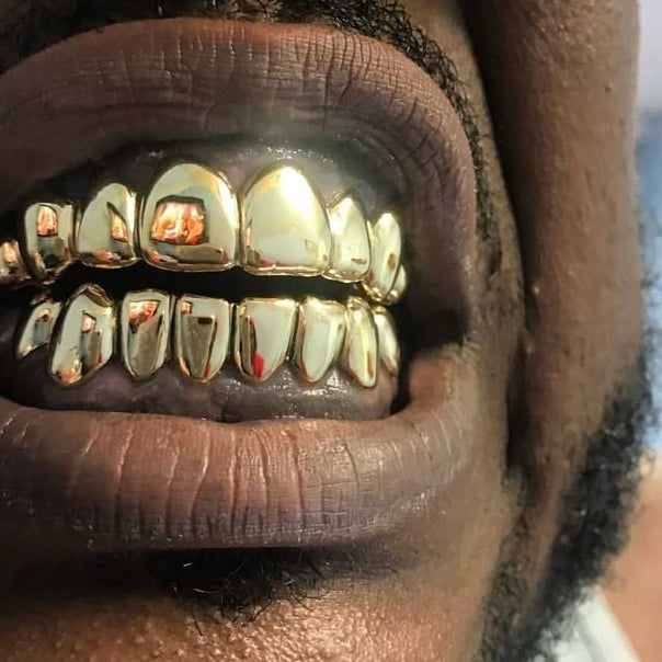 NPG 14 on 14 Grillz