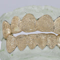 NPG Gold Diamond Dust Grillz