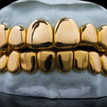 NPG Gold Plain Solid Grillz
